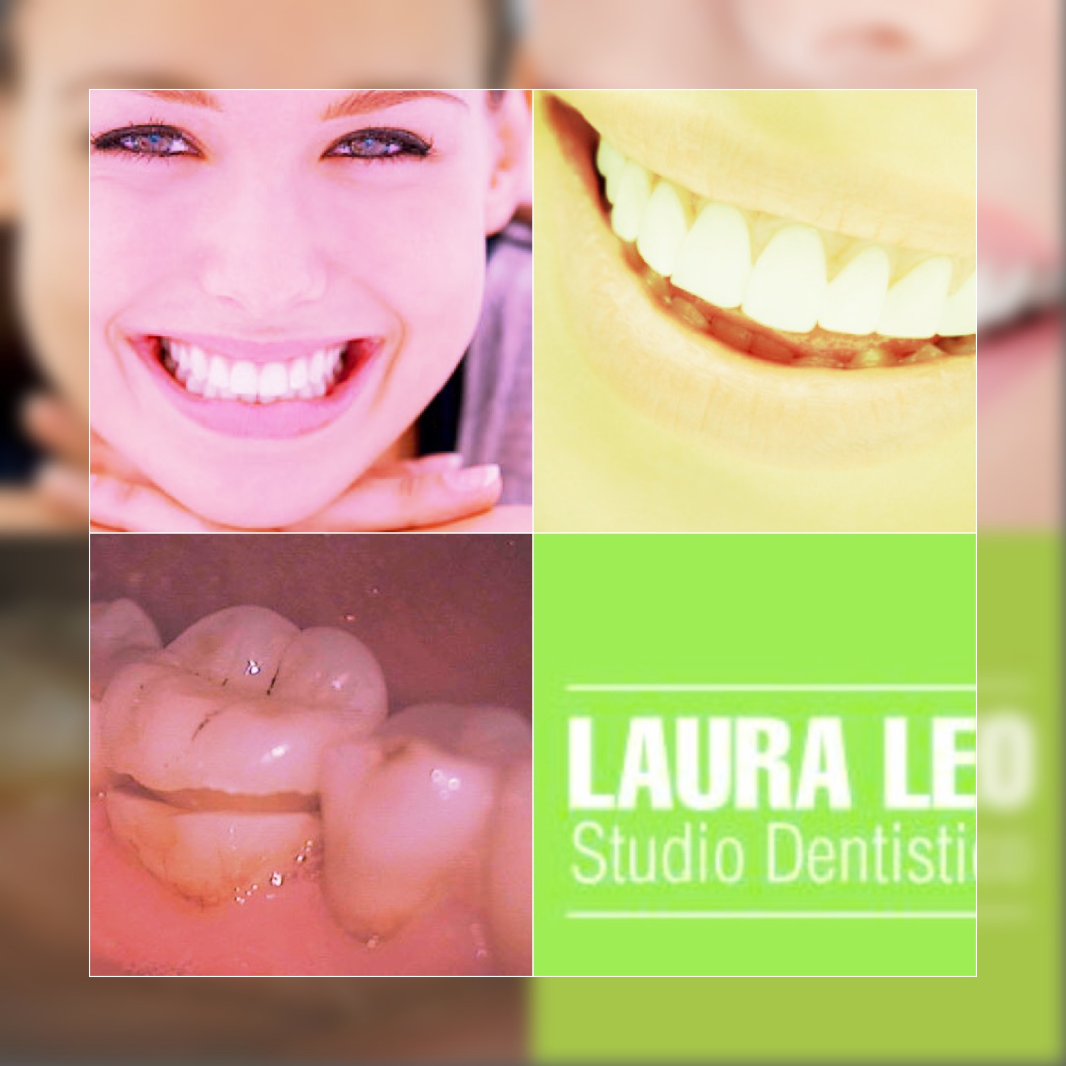 Studio Dentistico Laura Leo - Terapie - CONSERVATIVA
