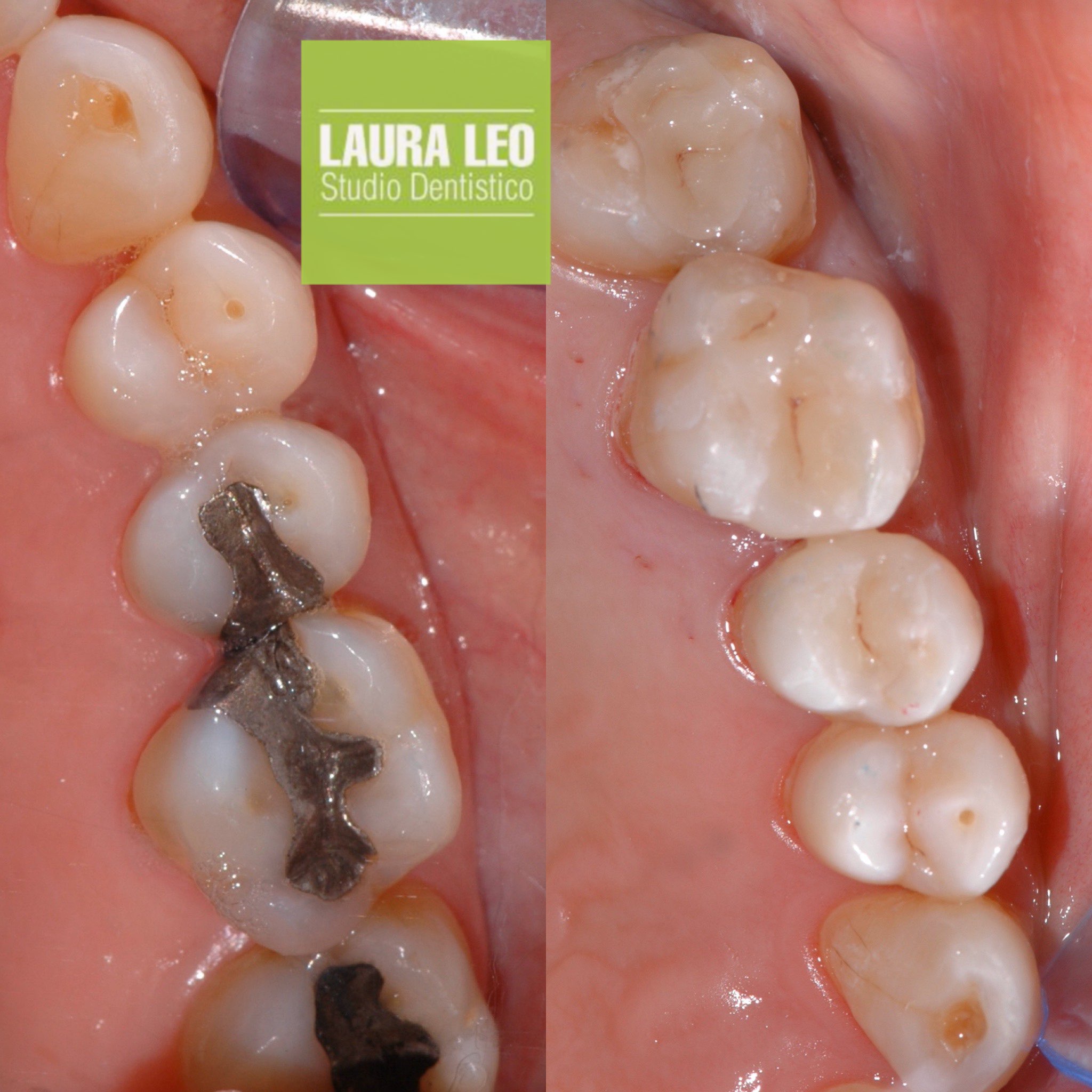 Studio Dentistico Laura Leo - Terapie - CONSERVATIVA