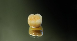 dente1